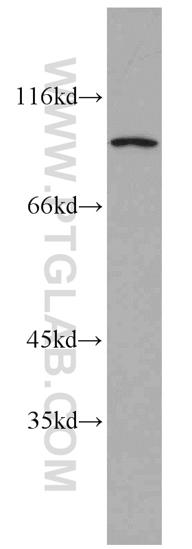 WB analysis of HepG2 using 12169-1-AP