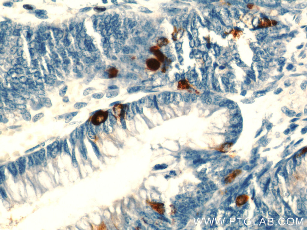 IHC staining of human colon using 23342-1-AP