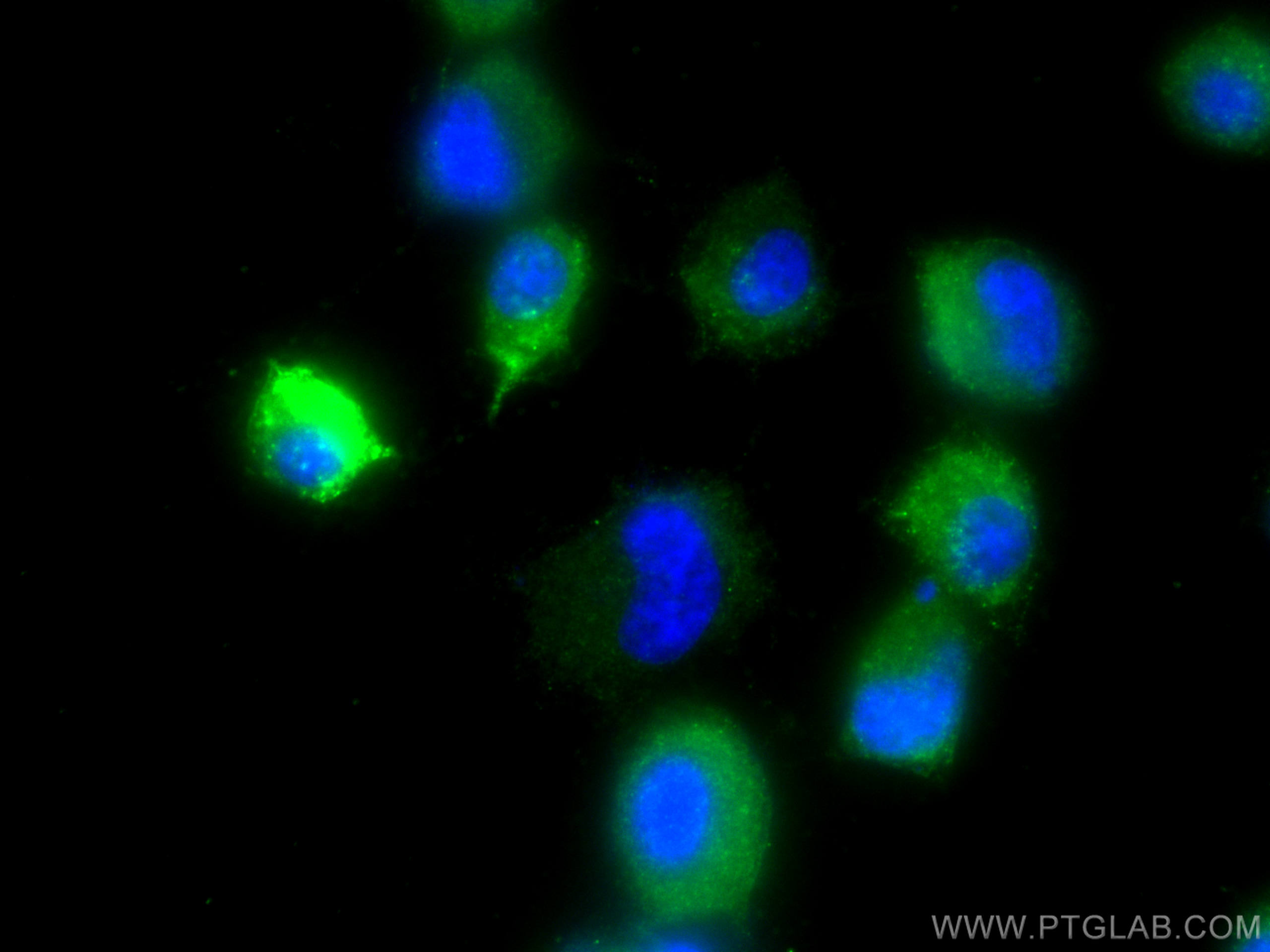 IF Staining of PC-12 using 14968-1-AP