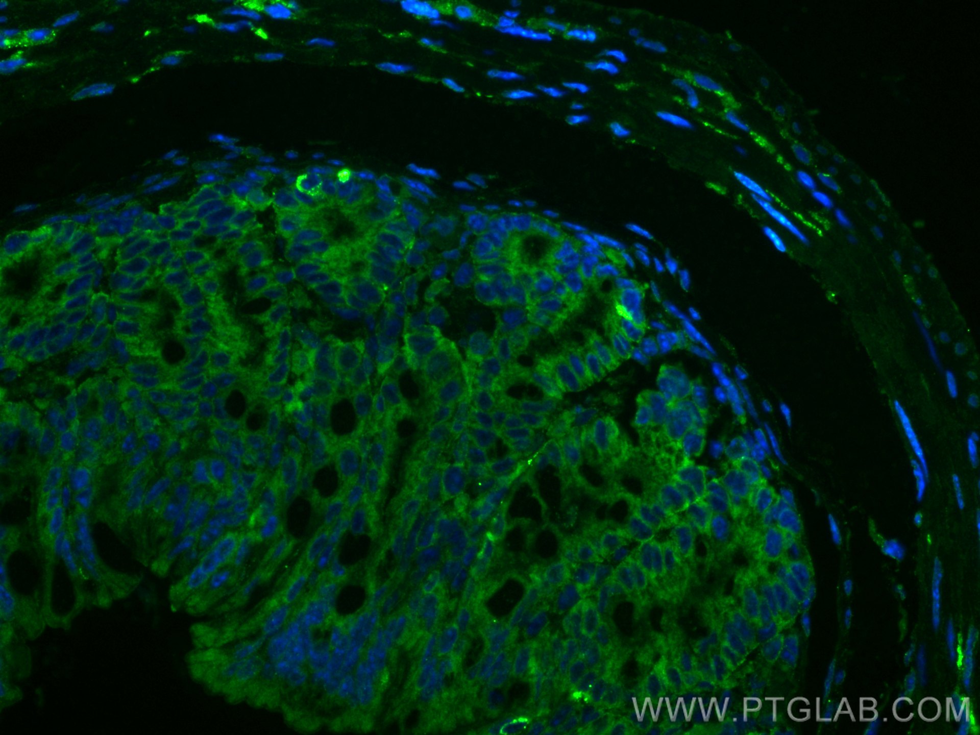 IF Staining of mouse colon using 14968-1-AP