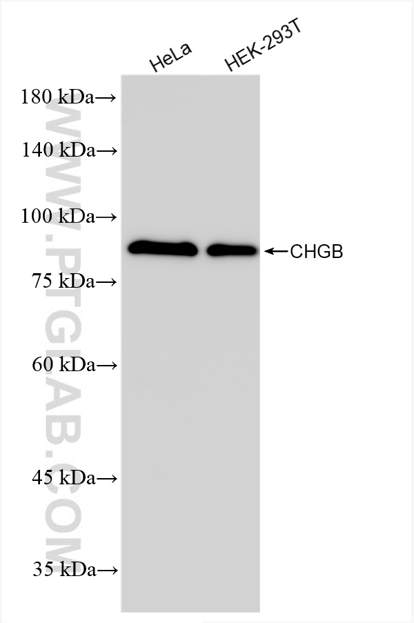 WB analysis using 85438-4-RR (same clone as 85438-4-PBS)