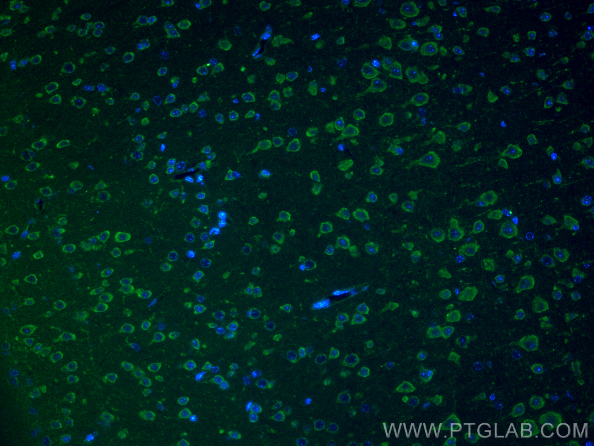 IF Staining of mouse brain using 12036-1-AP