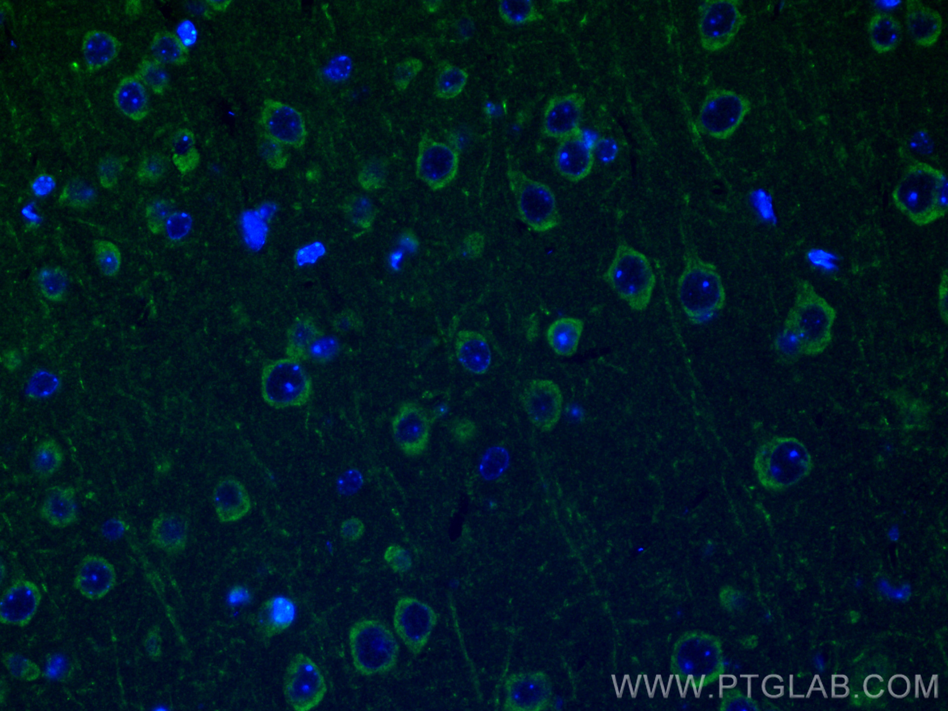 IF Staining of mouse brain using 12036-1-AP