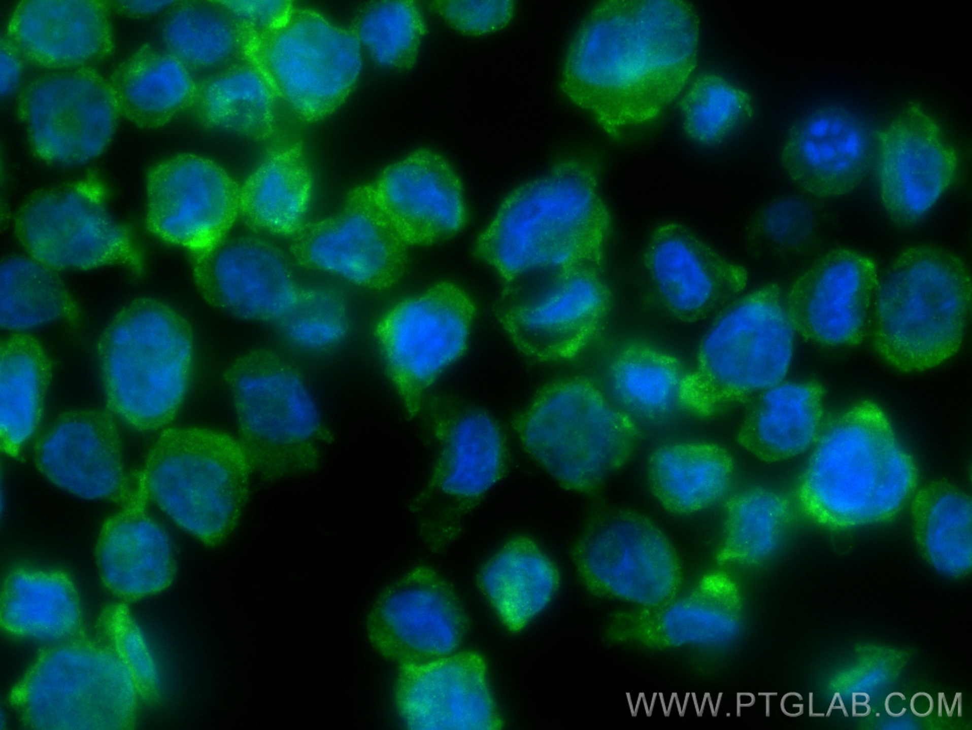 IF Staining of THP-1 using 30419-1-AP