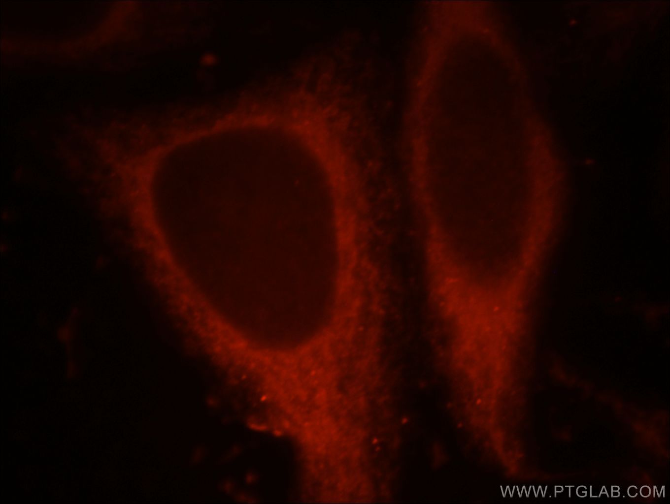 IF Staining of HepG2 using 21484-1-AP