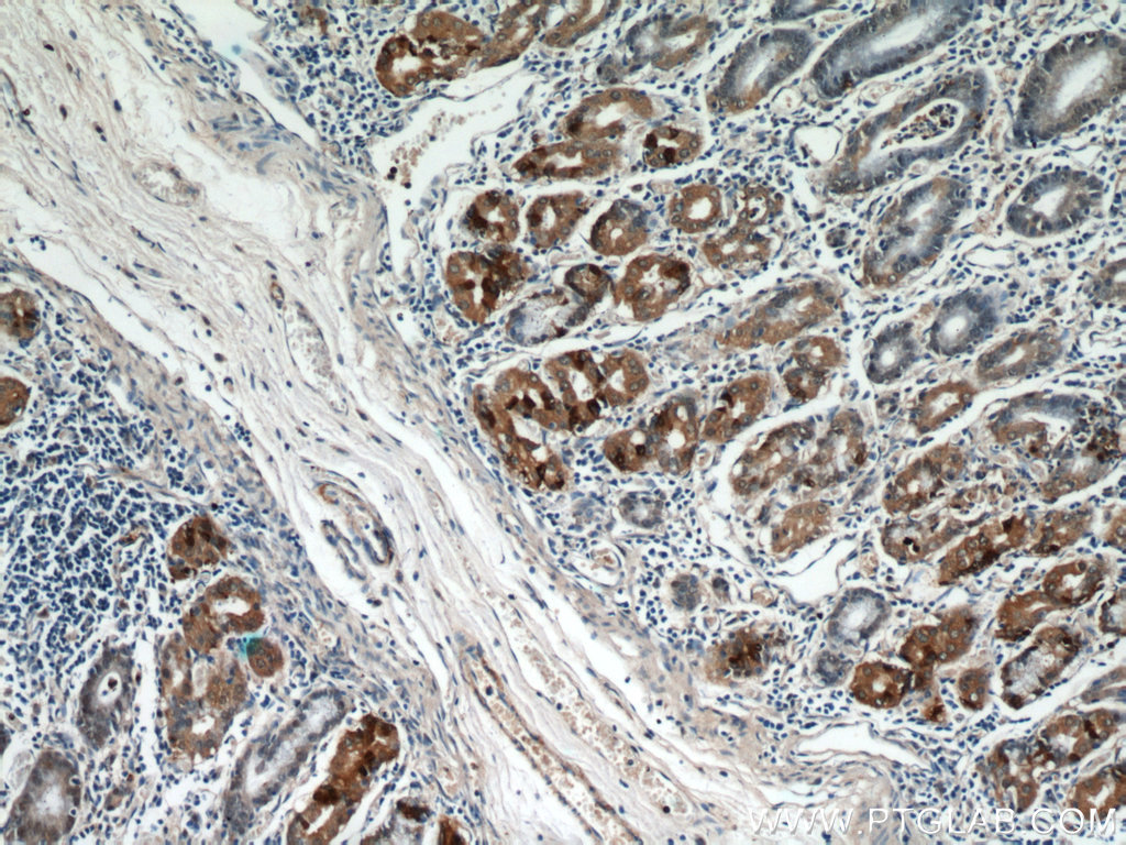 IHC staining of human stomach using 21484-1-AP