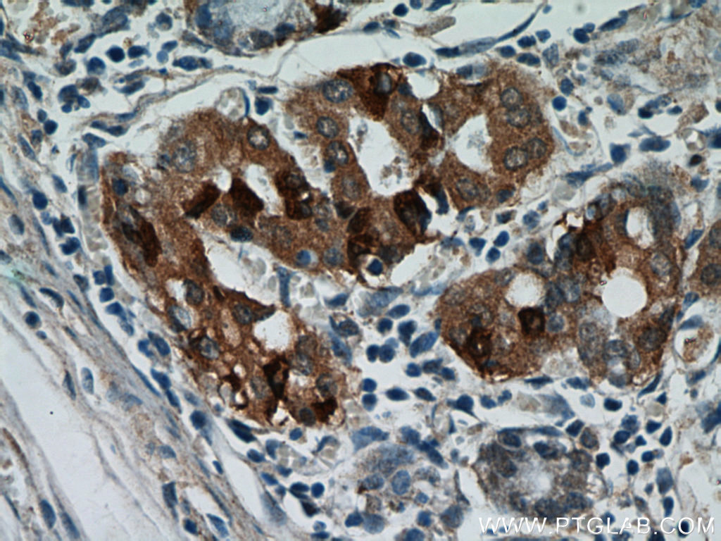 IHC staining of human stomach using 21484-1-AP