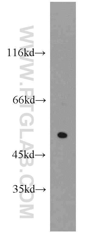 WB analysis of mouse lung using 21484-1-AP