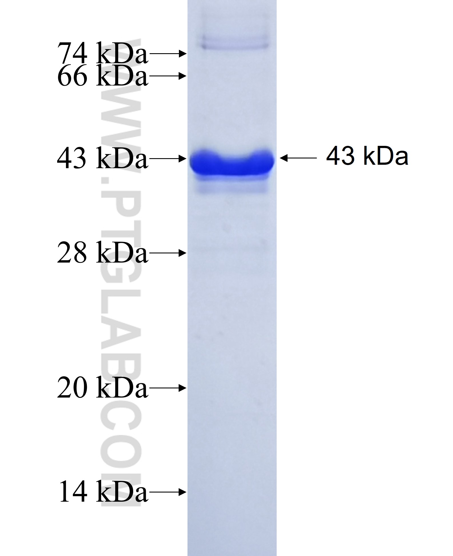 CHIA fusion protein Ag15767 SDS-PAGE