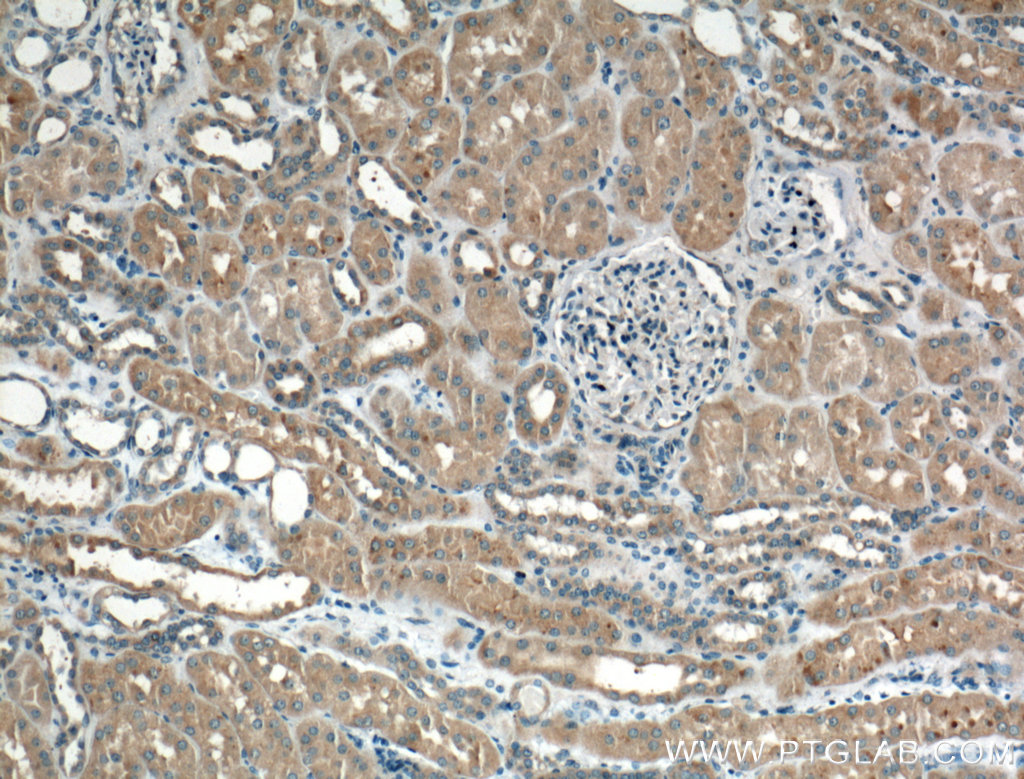 IHC staining of human kidney using 25887-1-AP