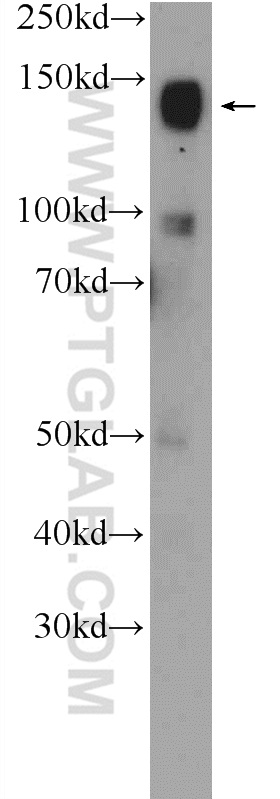 WB analysis of mouse brain using 25250-1-AP