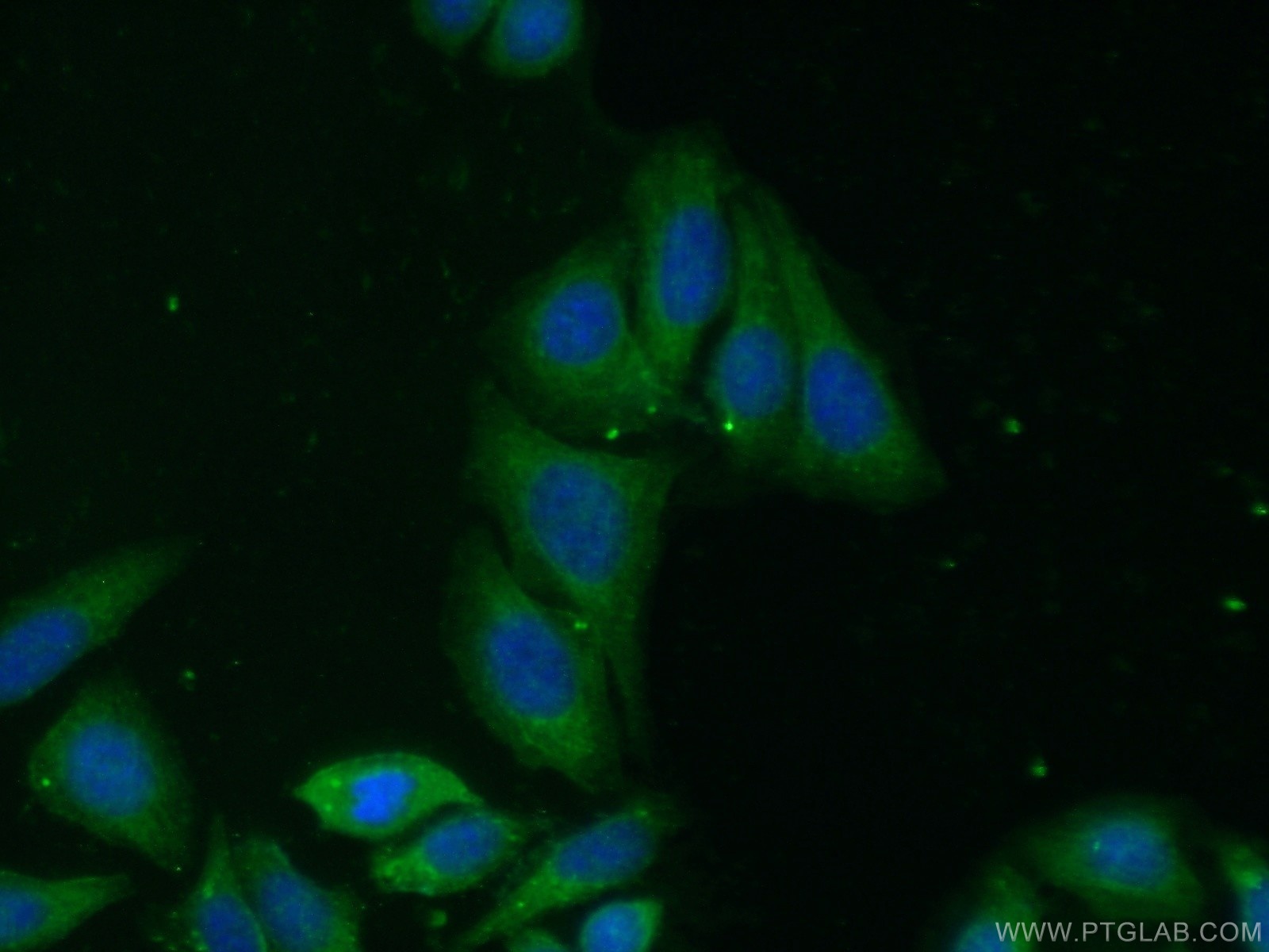 IF Staining of HepG2 using 15761-1-AP