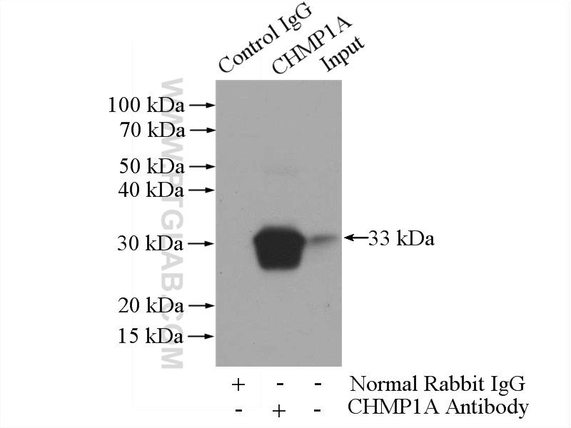 IP experiment of HEK-293 using 15761-1-AP