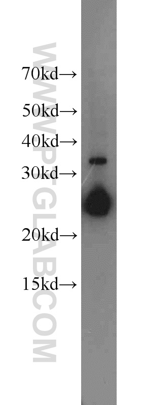 WB analysis of HEK-293 using 15761-1-AP