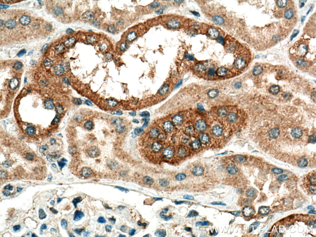 IHC staining of human kidney using 14639-1-AP