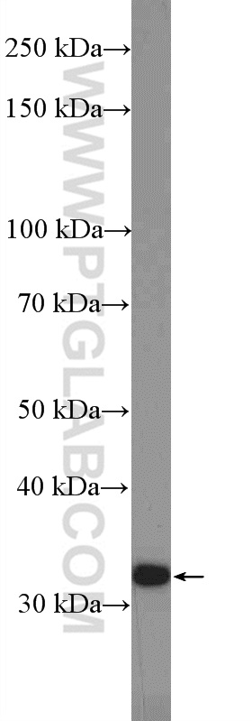 WB analysis of HepG2 using 10477-1-AP