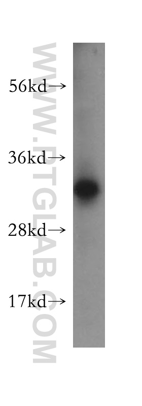 CHMP2A Polyclonal antibody