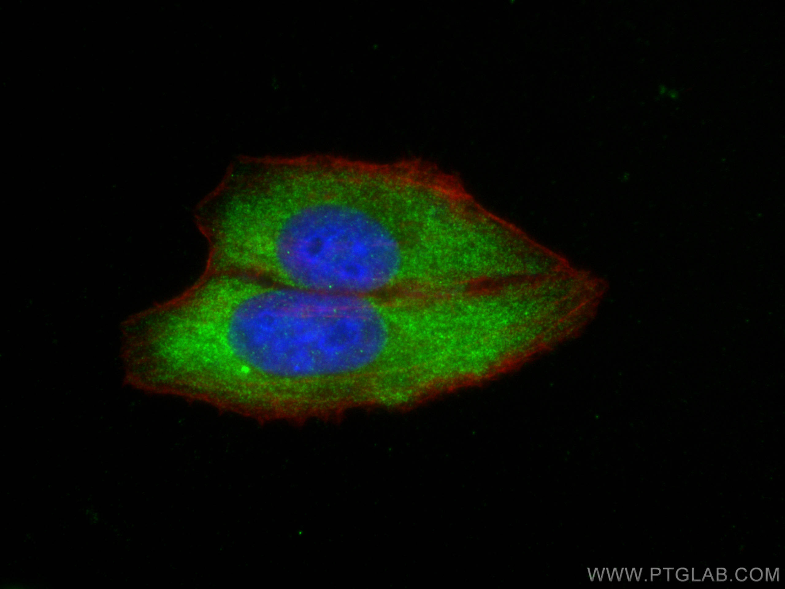 IF Staining of HepG2 using 12527-1-AP