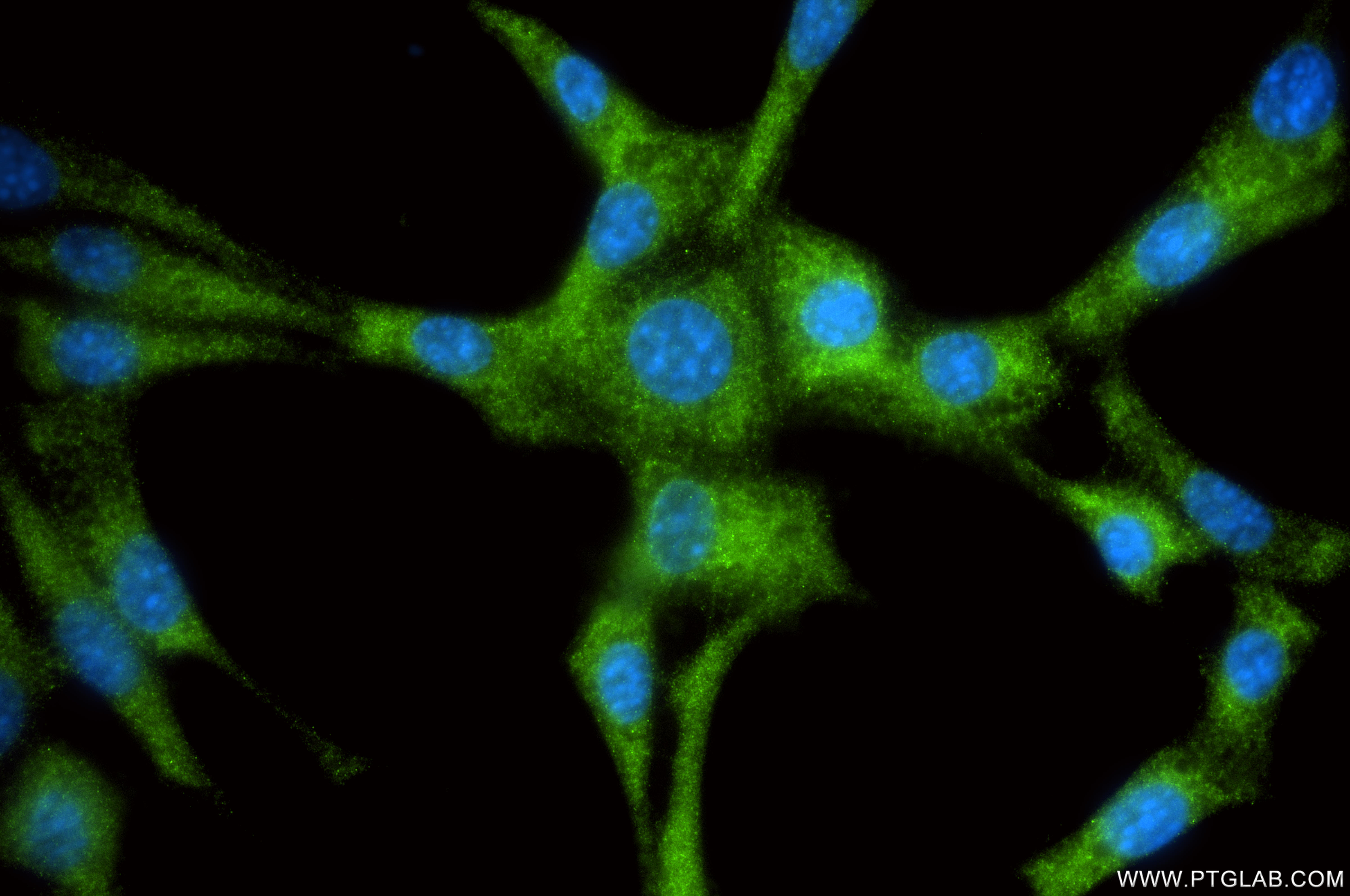 IF Staining of NIH/3T3 using 87151-1-RR IF Staining of NIH/3T3 using 87151-1-RR