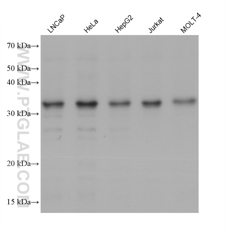 CHMP4B