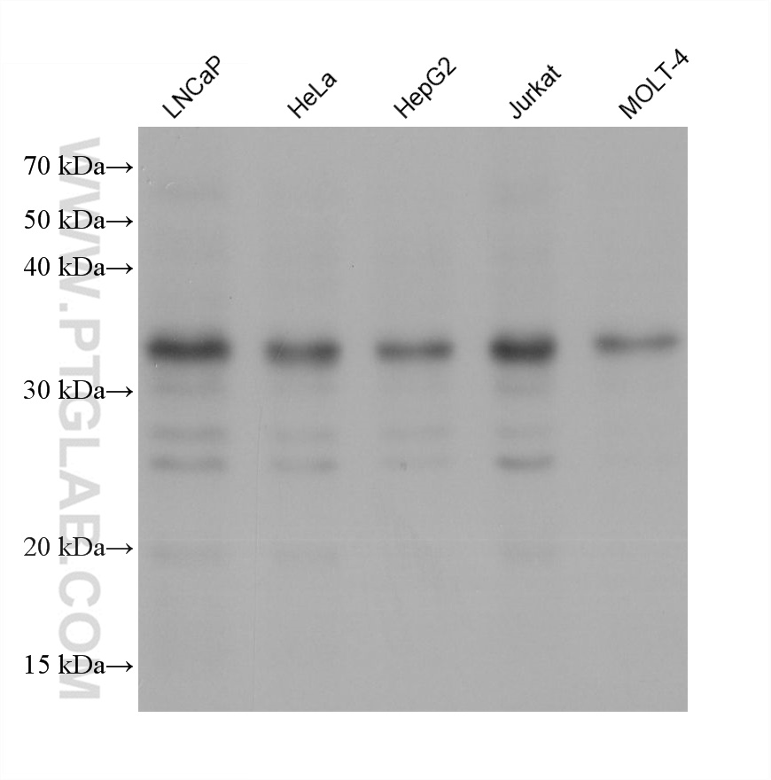 CHMP4B