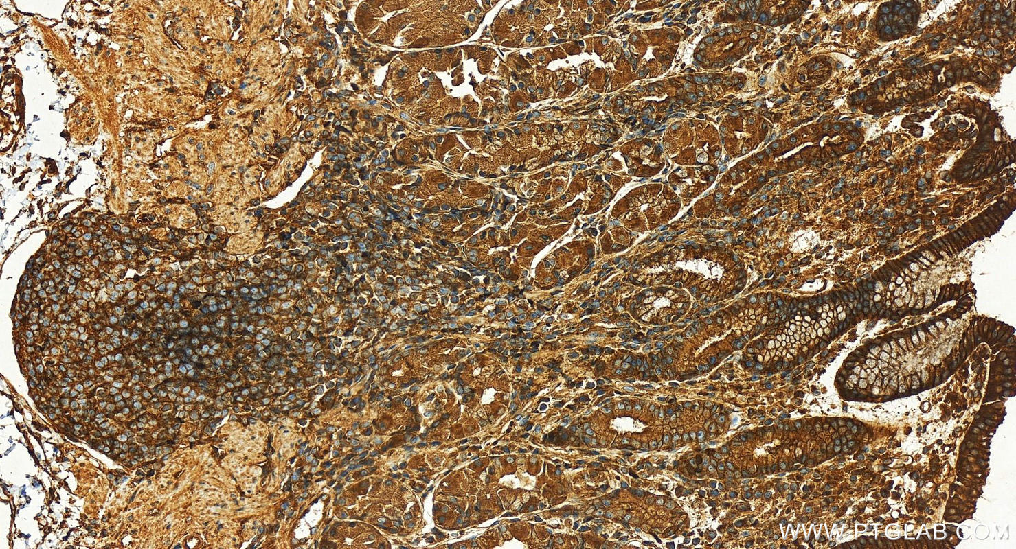 IHC staining of human stomach using 16278-1-AP