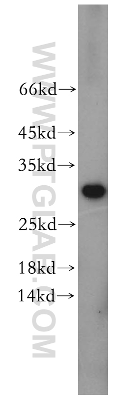 WB analysis of mouse testis using 16278-1-AP