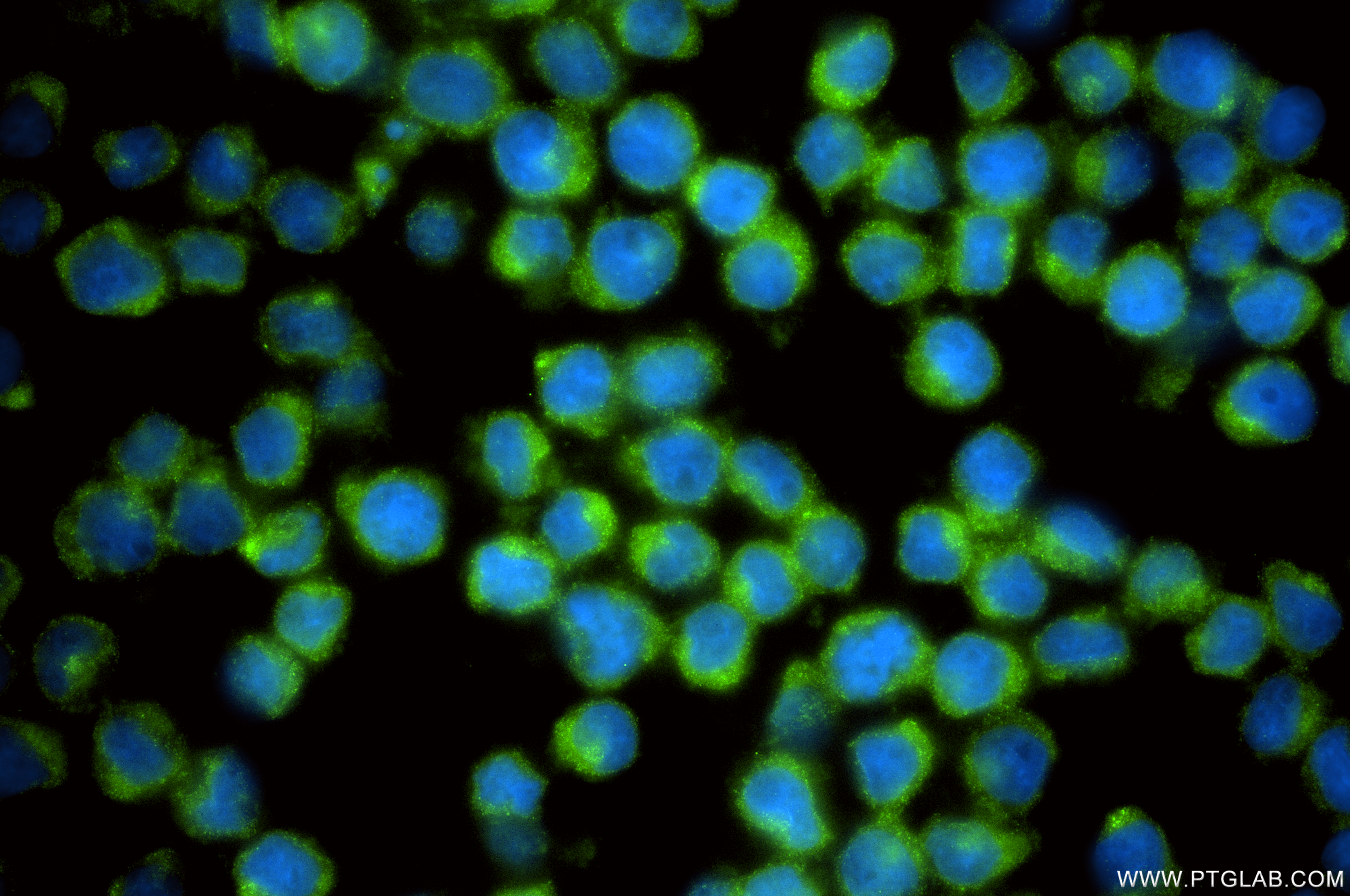 Immunofluorescent analysis of (4% PFA) fixed U-937 cells using CHMP6 antibody (<a class='green' href='/productredirect?CatalogNo=86474-3-RR' target='_blank'>86474-3-RR</a>, Clone: 251259C5 ) at dilution of 1:200 and CoraLite®488-Conjugated Goat Anti-Rabbit IgG(H+L) (<a class='green' href='/productredirect?CatalogNo=SA00013-2' target='_blank'>SA00013-2</a>). This data was developed using the same antibody clone with 86474-3-PBS in a different storage buffer formulation. IF Staining of U-937 using 86474-3-RR (same clone as 86474-3-PBS)