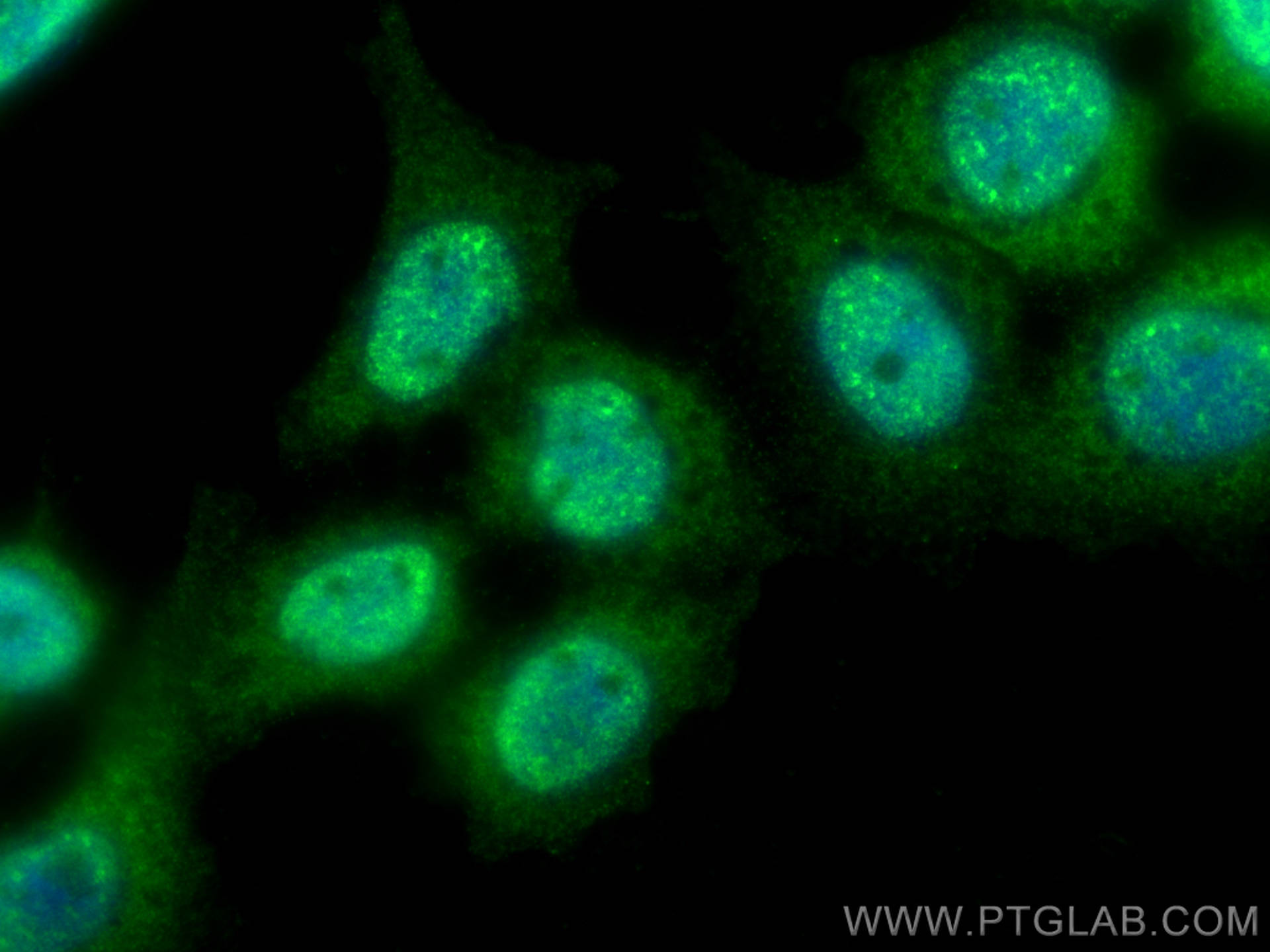 IF Staining of A431 using 16424-1-AP