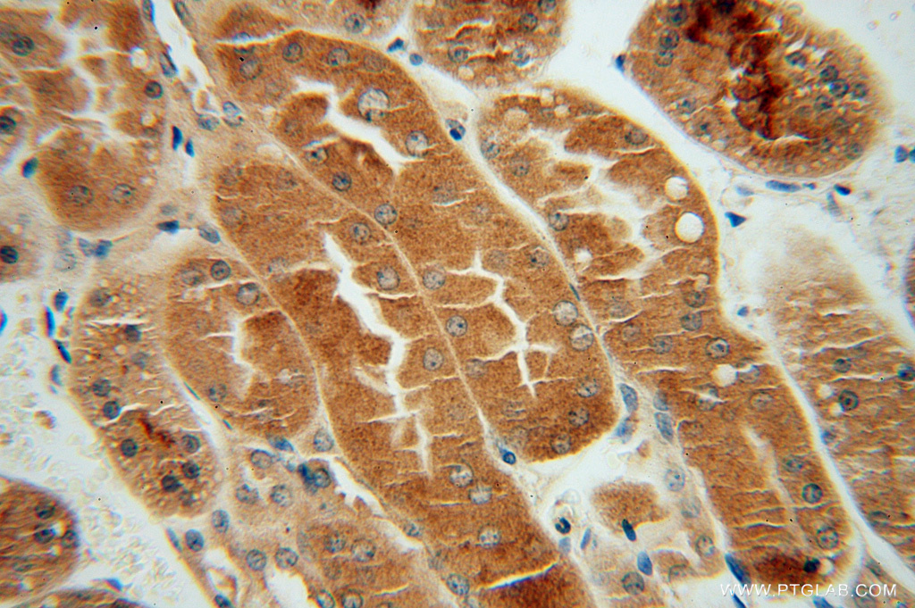 IHC staining of human kidney using 16424-1-AP