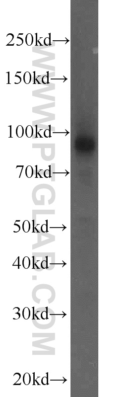 WB analysis of human placenta using 23953-1-AP