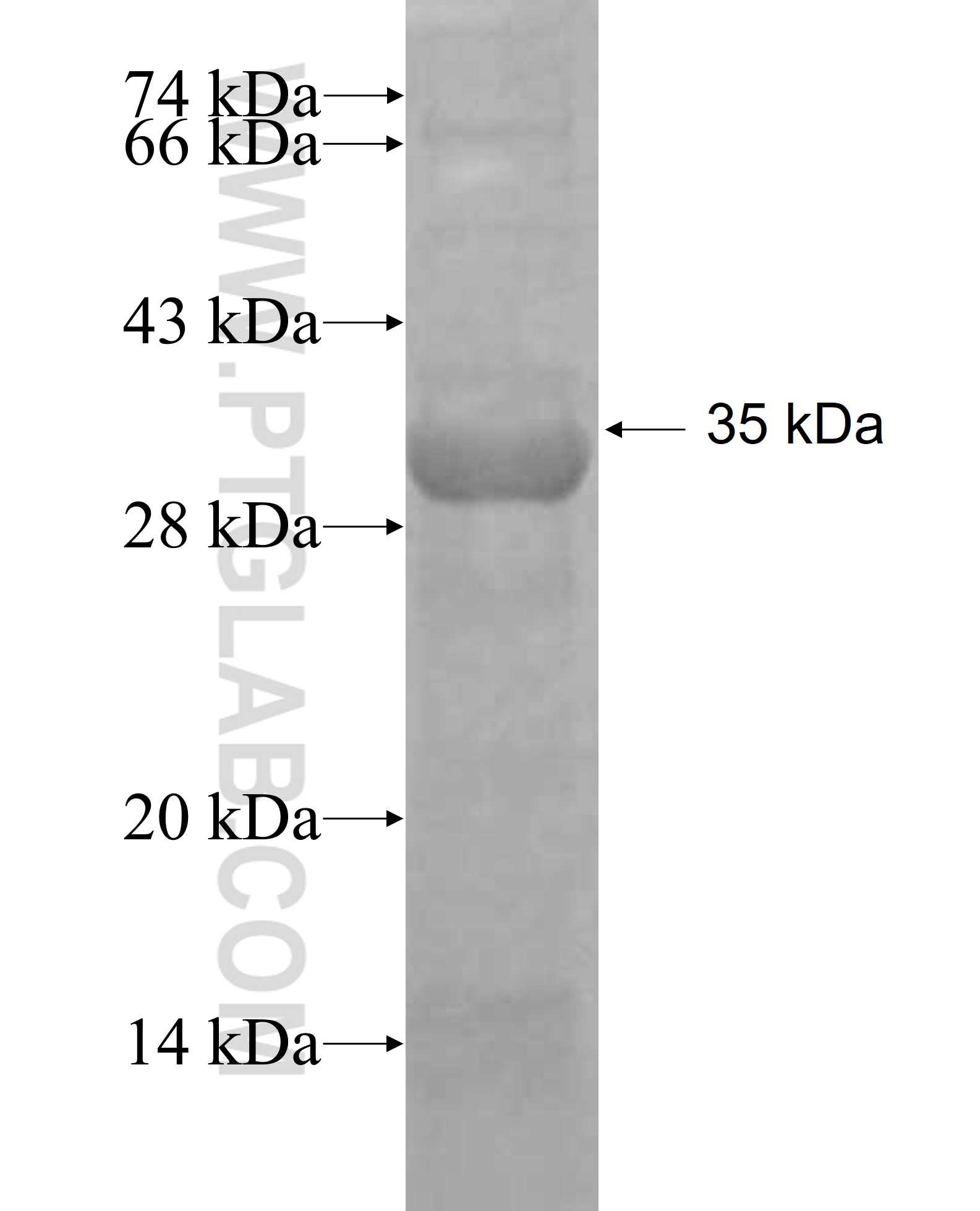 CHPT1 fusion protein Ag9797 SDS-PAGE