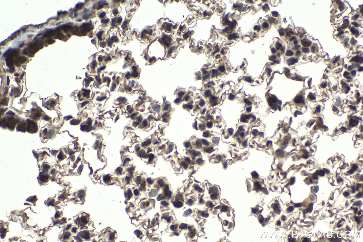 IHC staining of mouse lung using 12126-2-AP