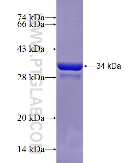 CHRAC1 fusion protein Ag29027 SDS-PAGE CHRAC1 fusion protein Ag29027 SDS-PAGE