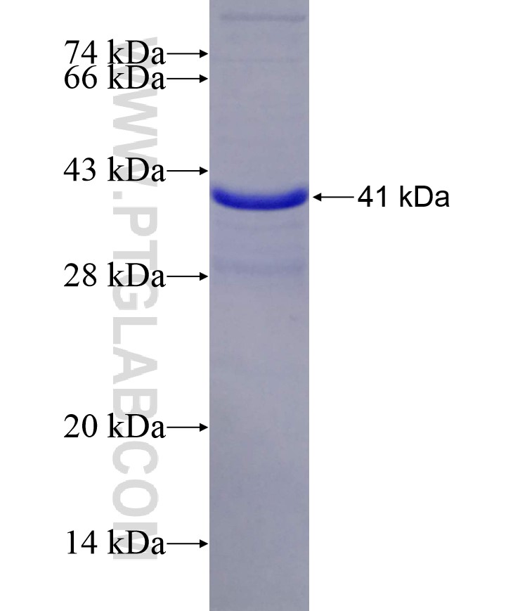 CHRAC1 fusion protein Ag2770 SDS-PAGE