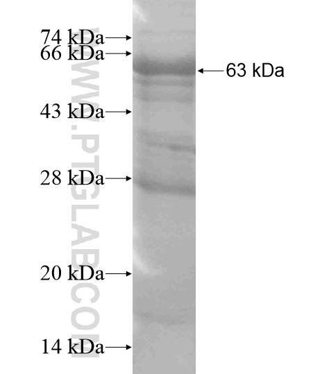 CHRD fusion protein Ag18819 SDS-PAGE