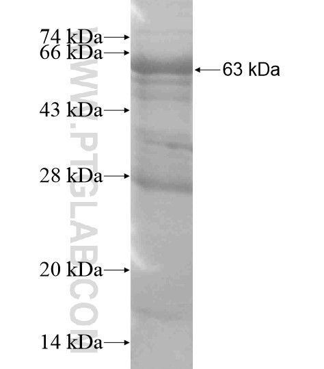 CHRD fusion protein Ag18819 SDS-PAGE CHRD fusion protein Ag18819 SDS-PAGE