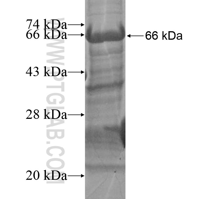 CHRDL2 fusion protein Ag15757 SDS-PAGE CHRDL2 fusion protein Ag15757 SDS-PAGE