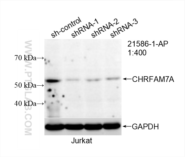 WB analysis of Jurkat using 21586-1-AP (same clone as 21586-1-PBS)