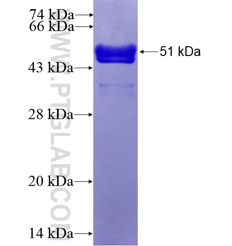 CHRM1 fusion protein Ag14918 SDS-PAGE CHRM1 fusion protein Ag14918 SDS-PAGE