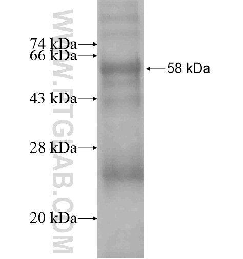 CHRM2 fusion protein Ag15859 SDS-PAGE CHRM2 fusion protein Ag15859 SDS-PAGE
