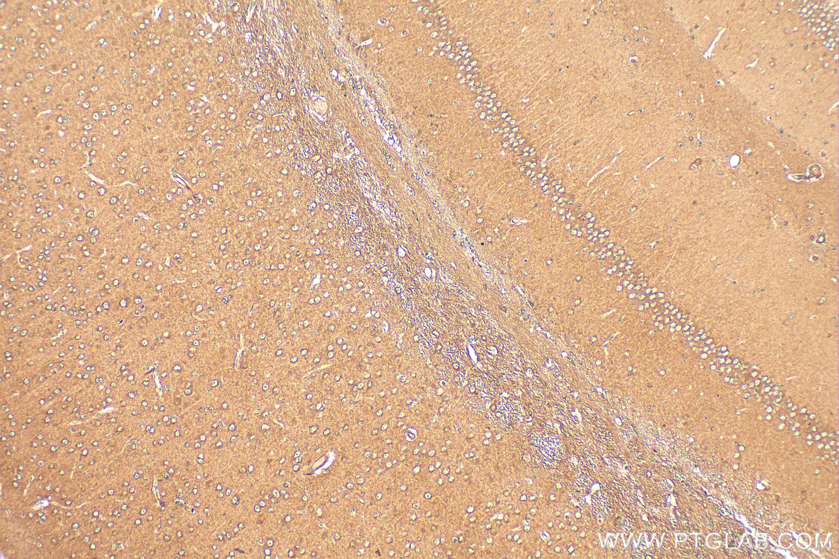 Immunohistochemical analysis of paraffin-embedded mouse brain tissue slide using 21978-1-AP (CHRM3 antibody) at dilution of 1:200 (under 10x lens). Heat mediated antigen retrieval with Tris-EDTA buffer (pH 9.0). IHC staining of mouse brain using 21978-1-AP