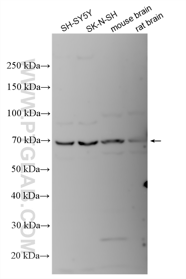 Various lysates were subjected to SDS PAGE followed by western blot with 21978-1-AP (CHRM3 antibody) at dilution of 1:3000 incubated at room temperature for 1.5 hours. WB analysis using 21978-1-AP