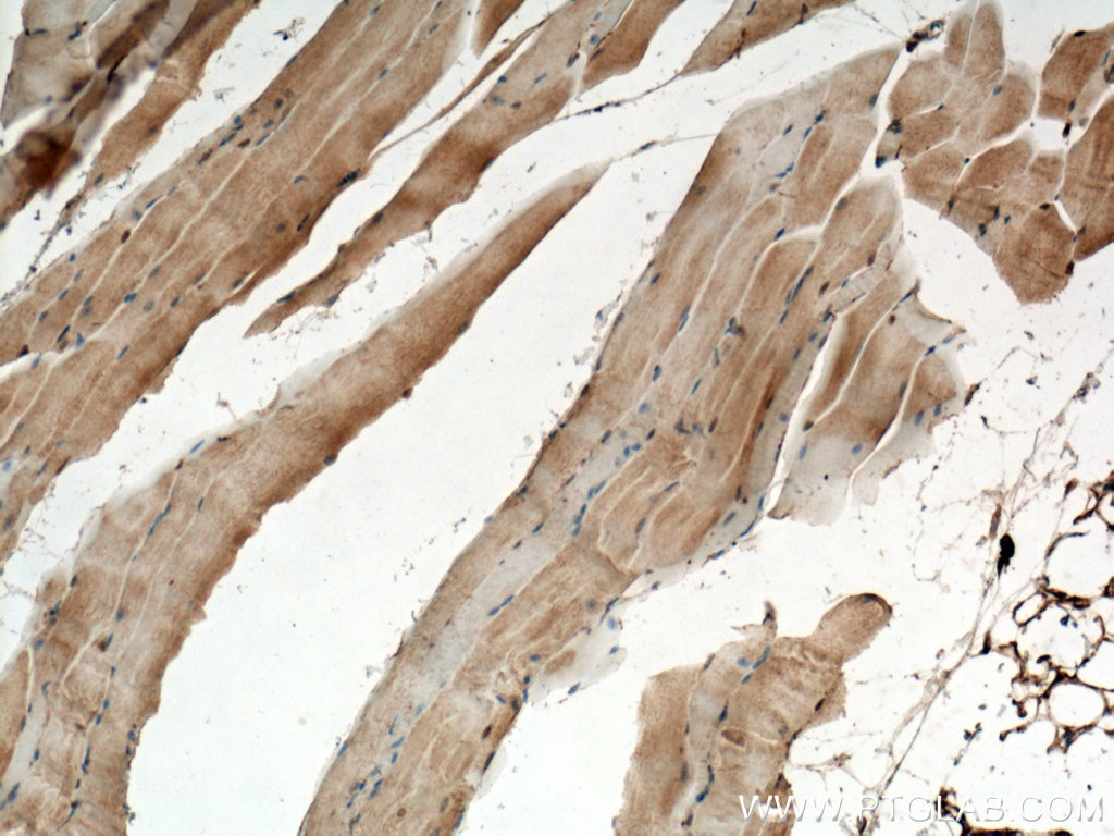 IHC staining of mouse skeletal muscle using 10613-1-AP