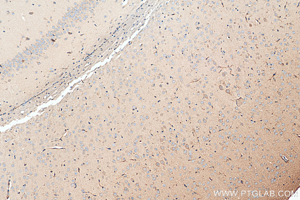 IHC staining of mouse brain using 10333-1-AP