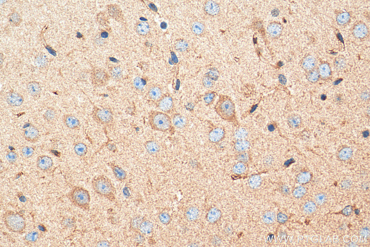 IHC staining of mouse brain using 10333-1-AP