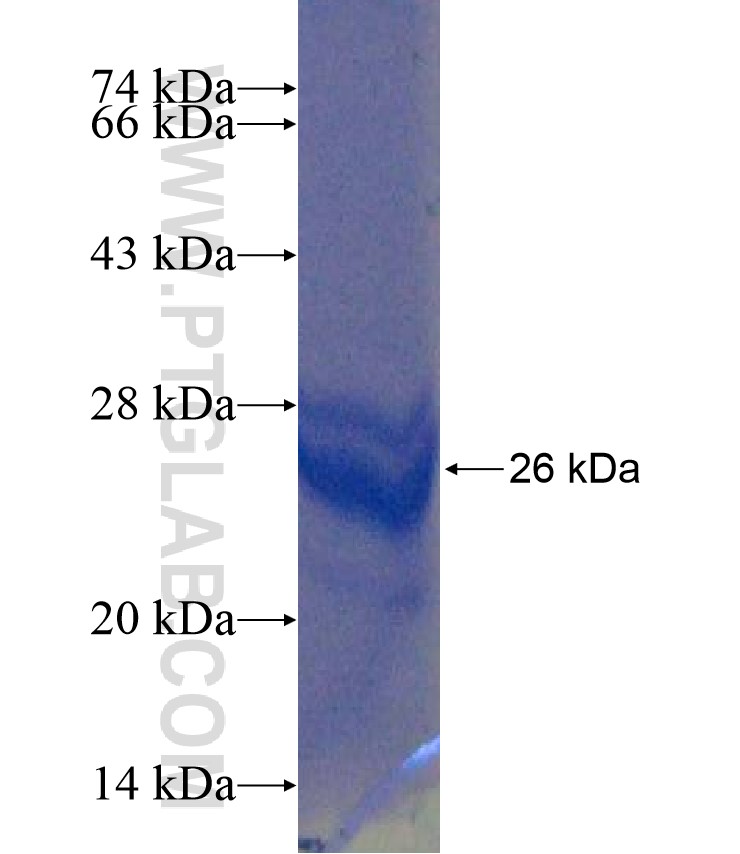 CHRNA3 fusion protein Ag17602 SDS-PAGE CHRNA3 fusion protein Ag17602 SDS-PAGE