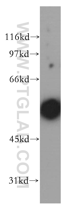 CHRNA5