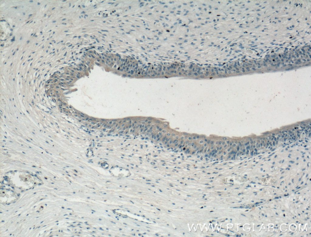 IHC staining of human bladder using 66363-1-Ig