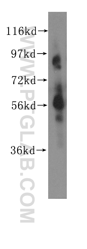 CHRNA6